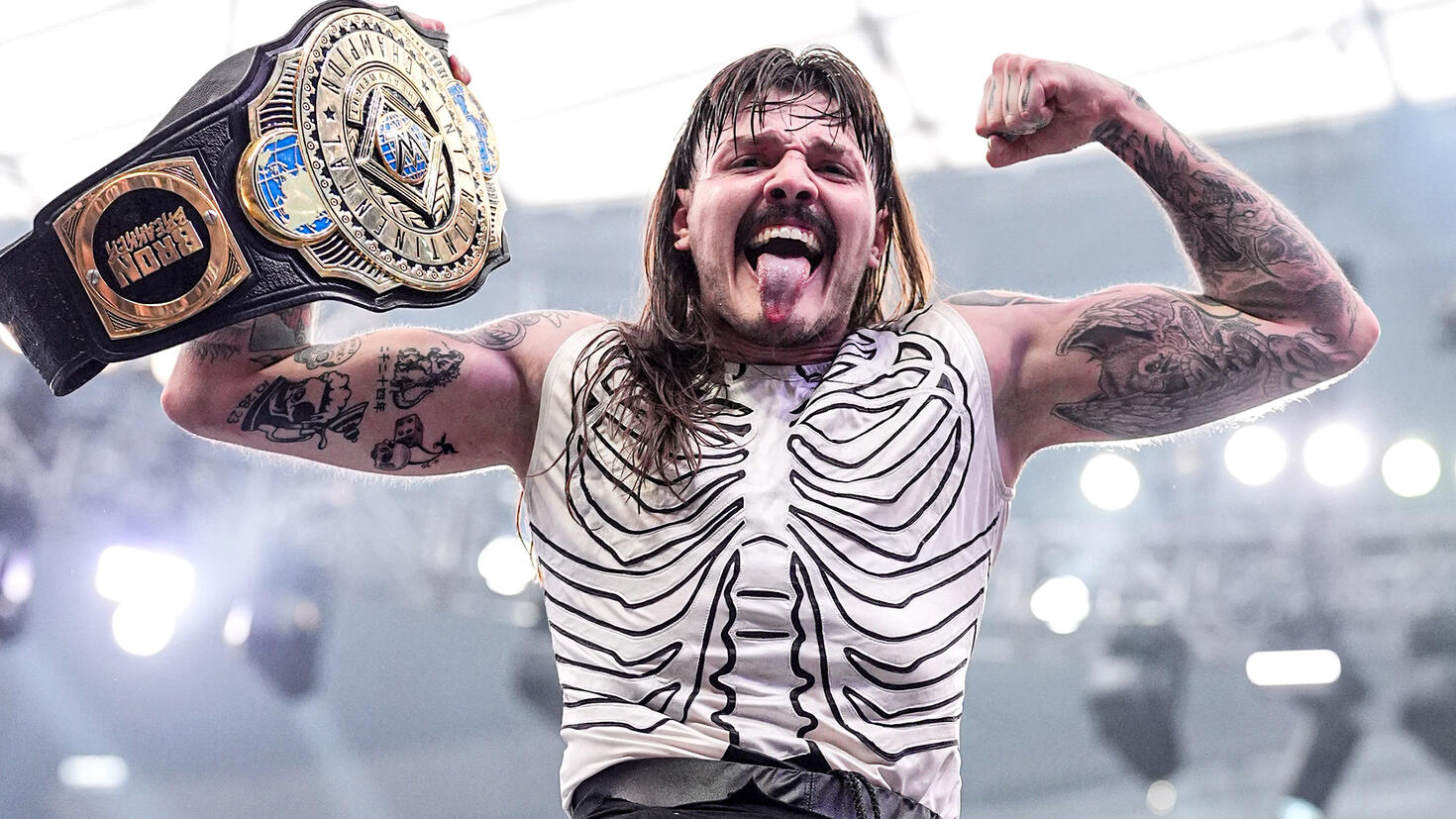 Dominik Mysterio Injury Update